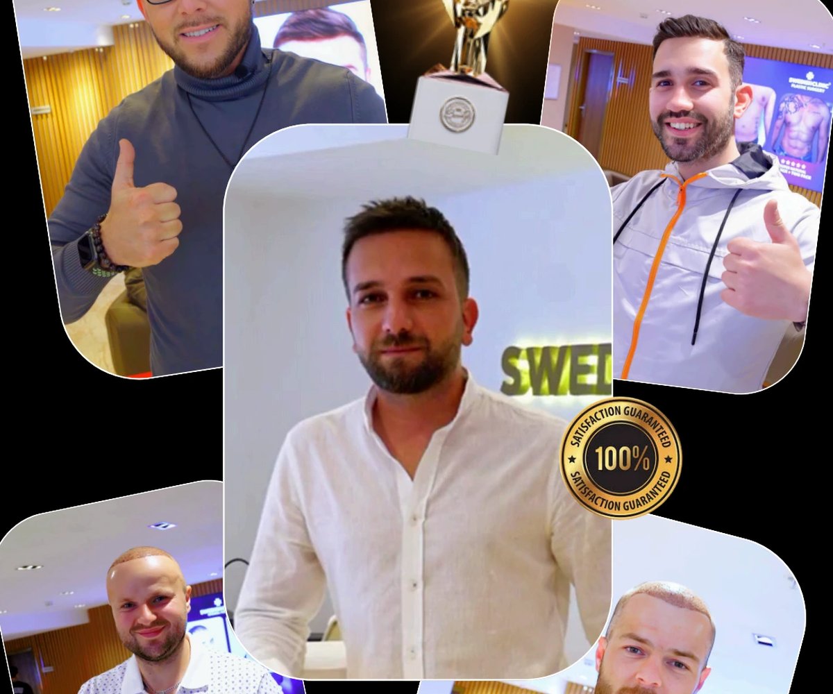 Trapianto di barba