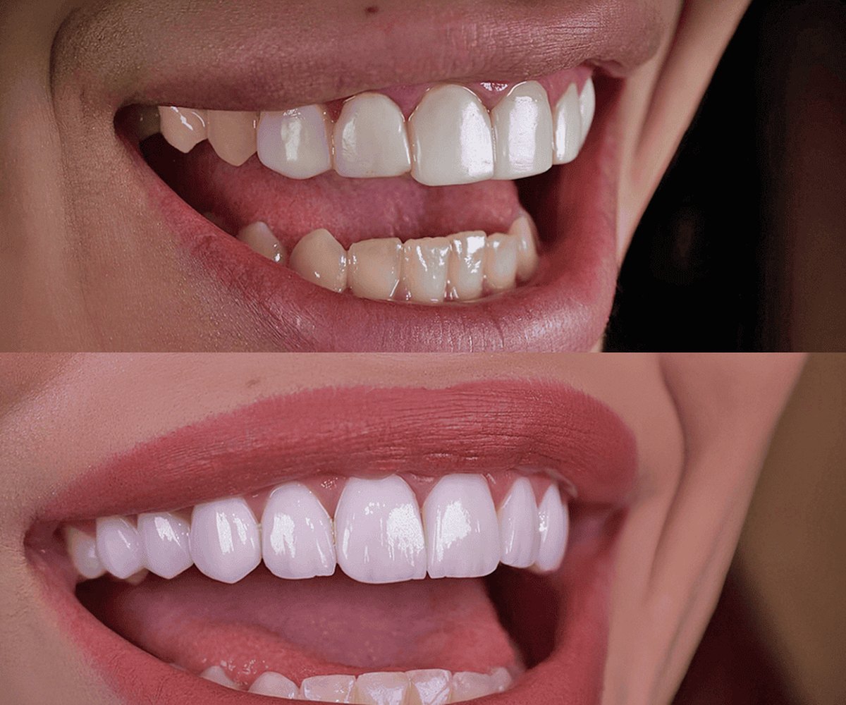 Sonrisa Hollywood