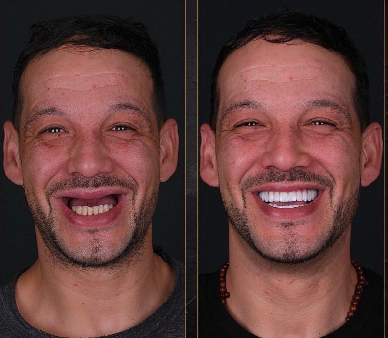 Before and after