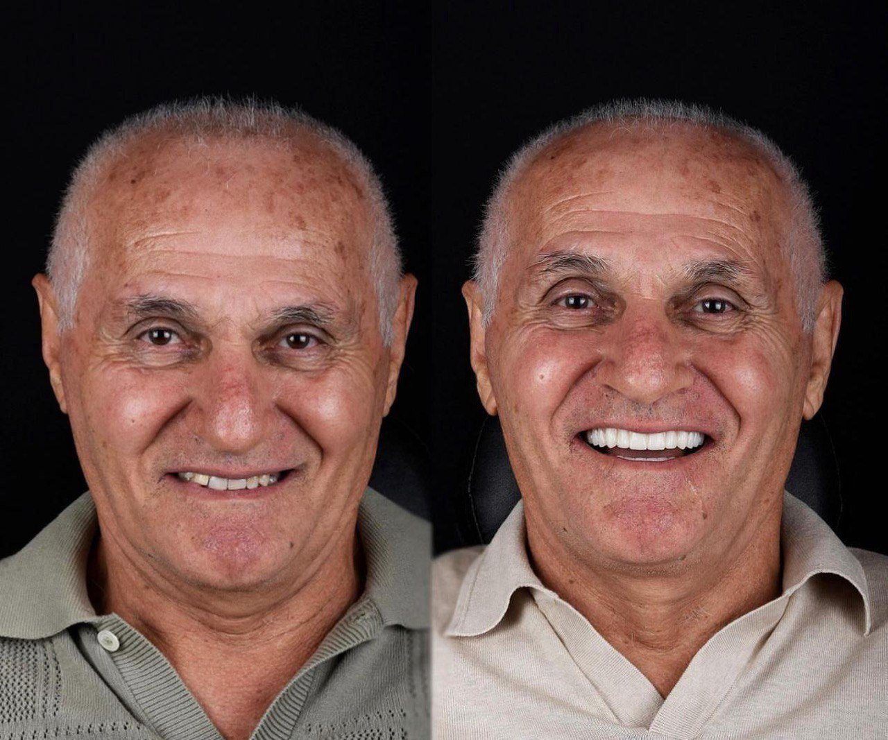 Before and after