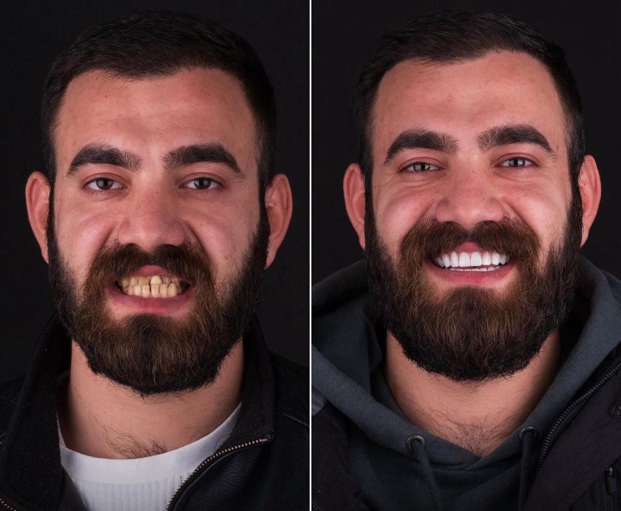 Before and after
