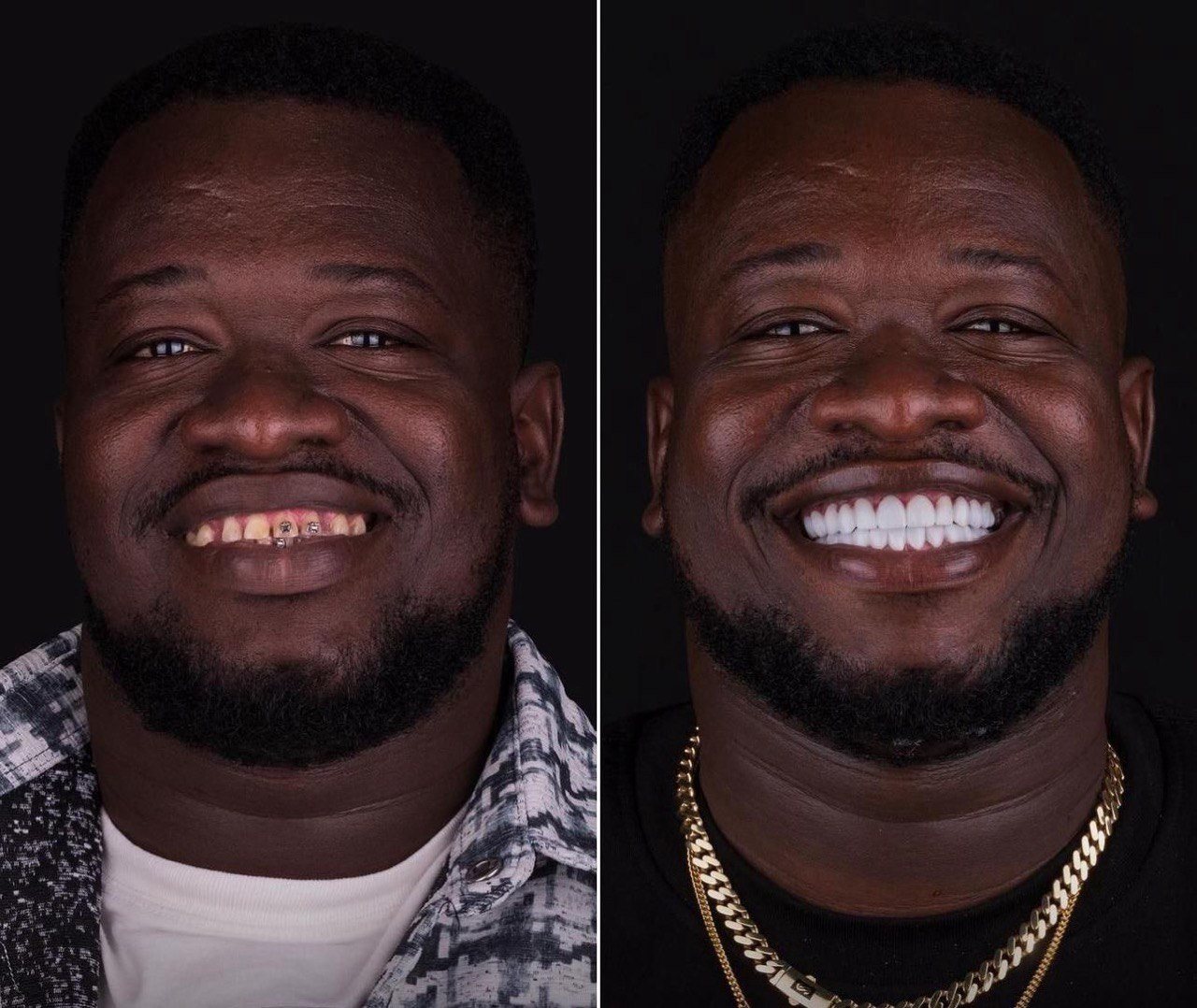 Before and after