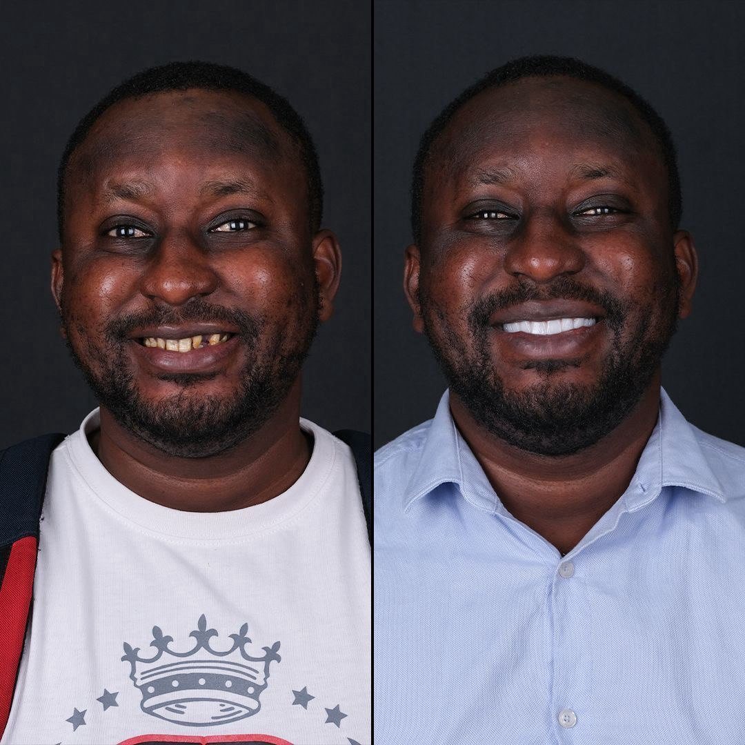 Before and after
