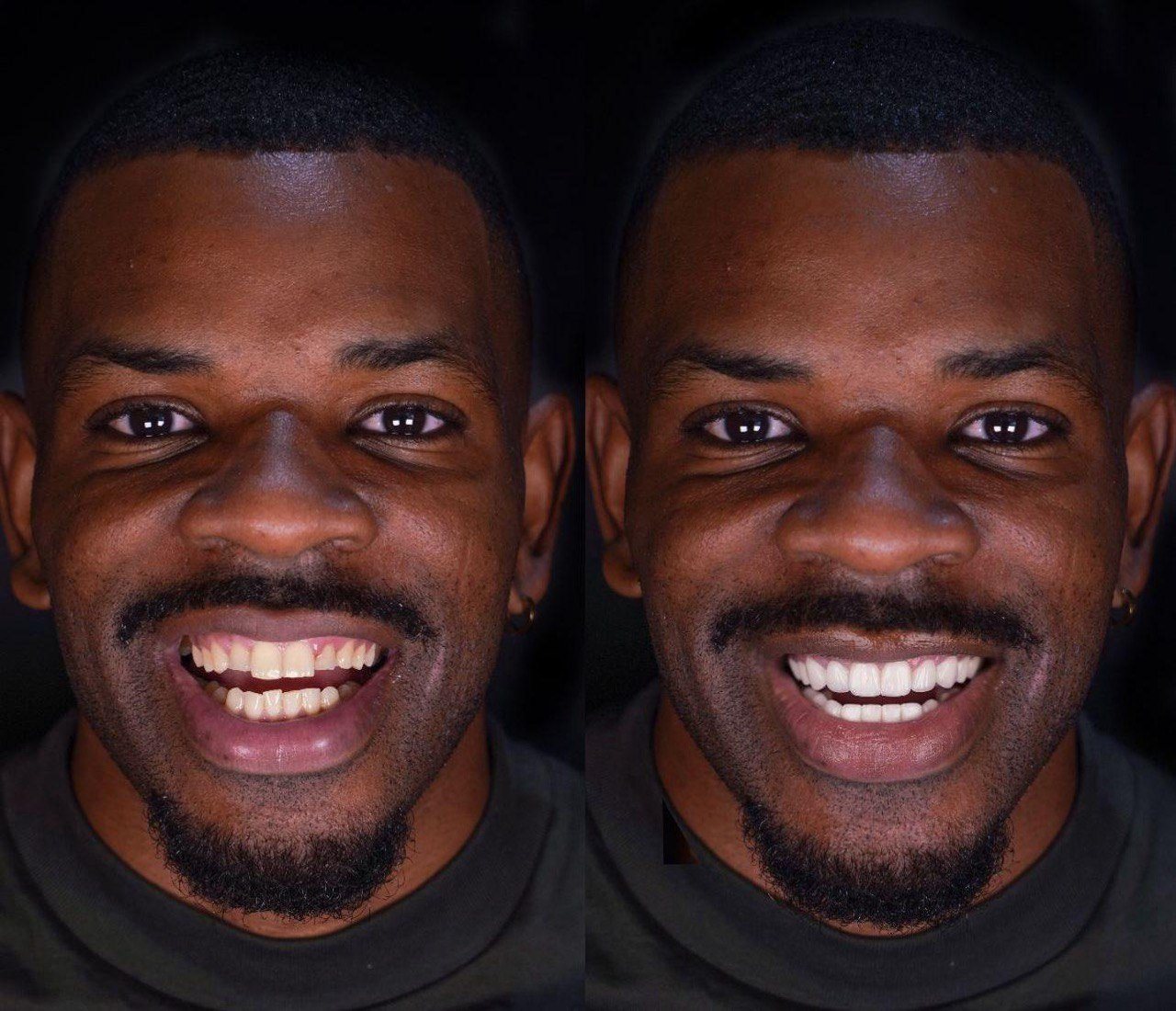 Before and after
