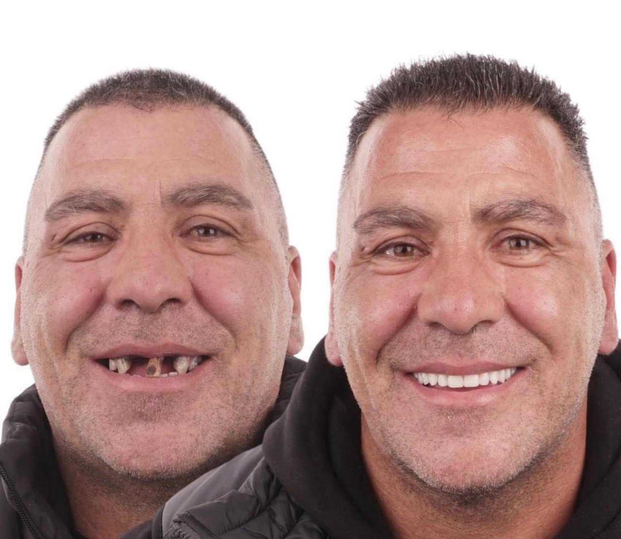 Before and after