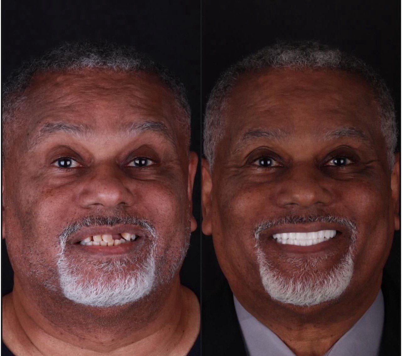 Before and after