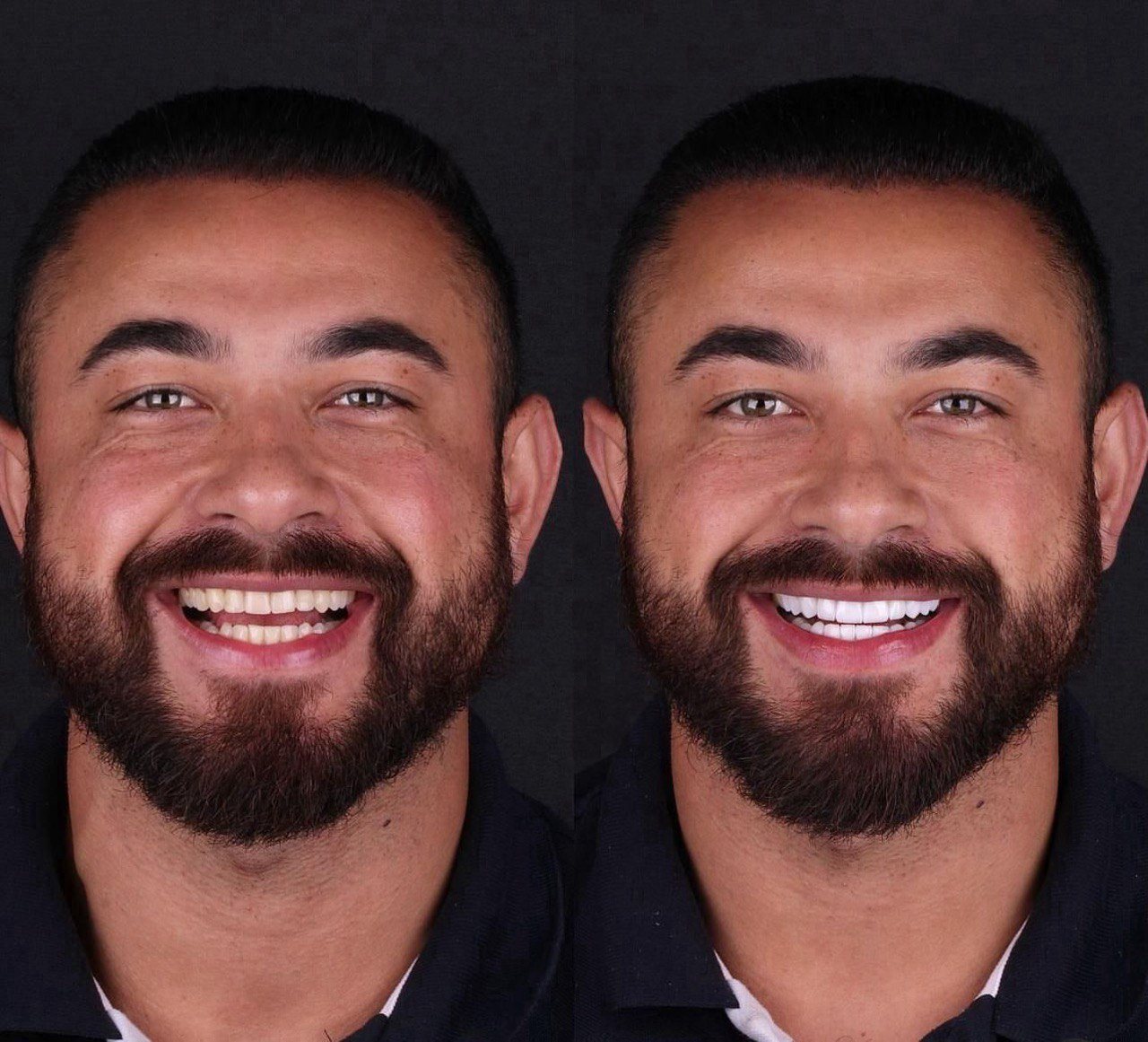 Before and after