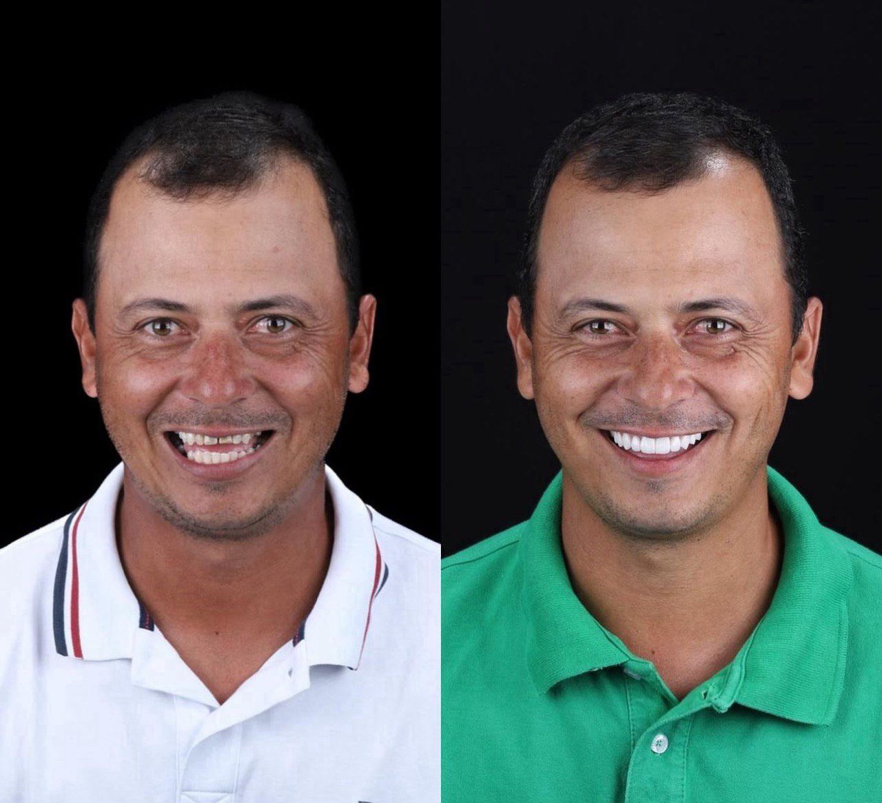 Before and after