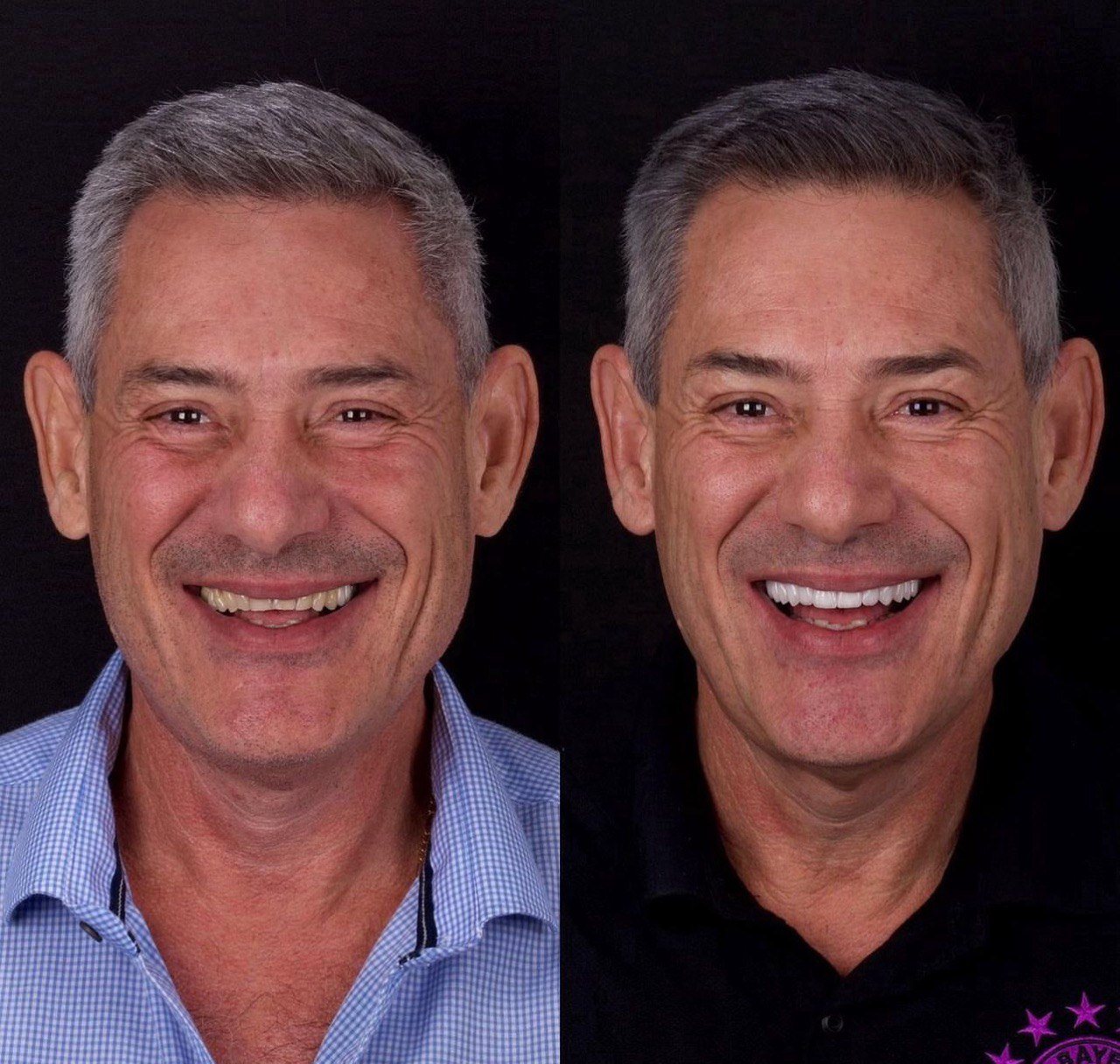 Before and after