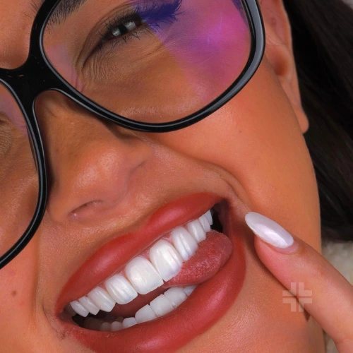 Finished smile