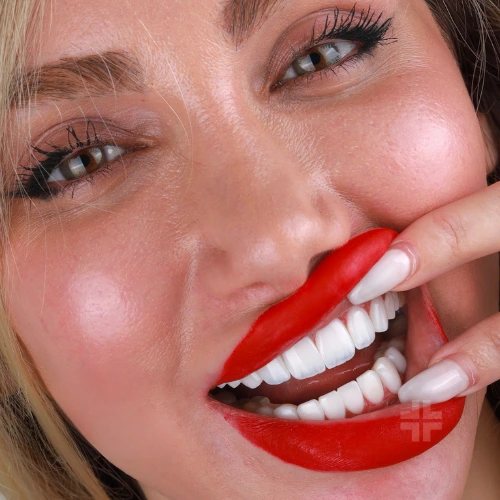Finished smile