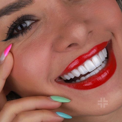 Finished smile