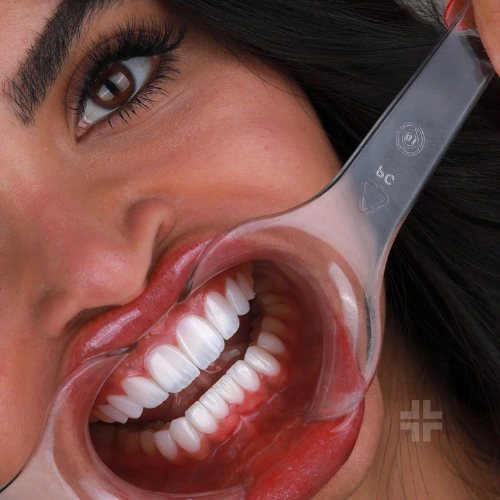 Finished smile