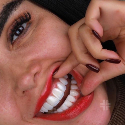 Finished smile