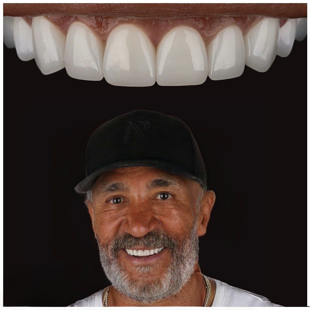 Dental result