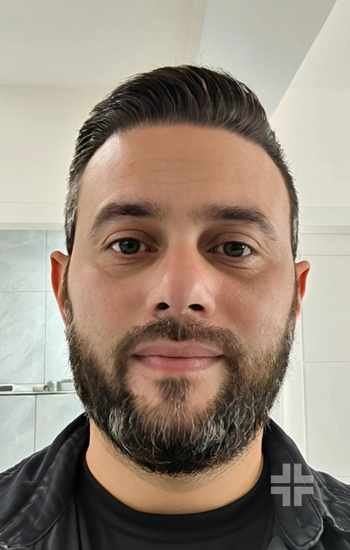 Before and after