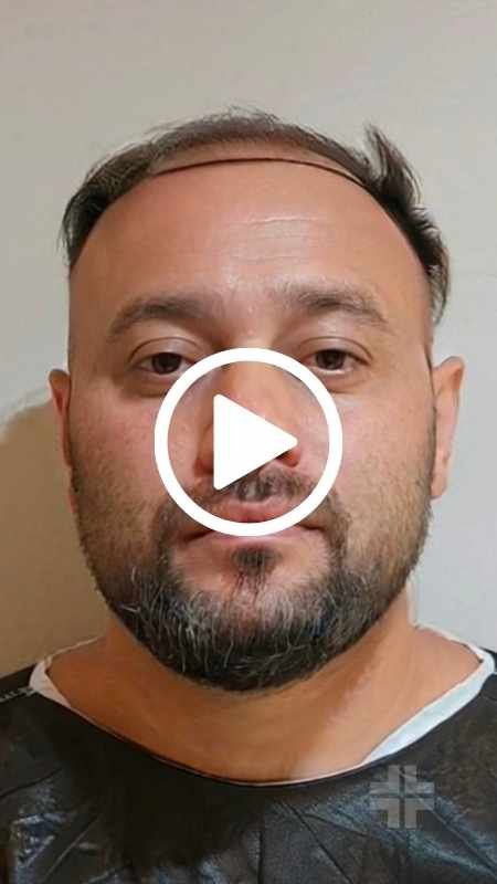 Il mio percorso di trapianto