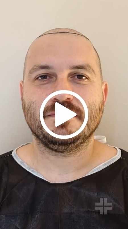 Un anno dopo