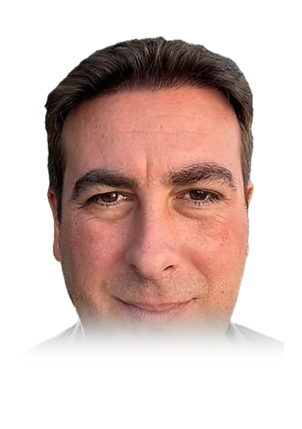 Marcus H. — hair transplant, after