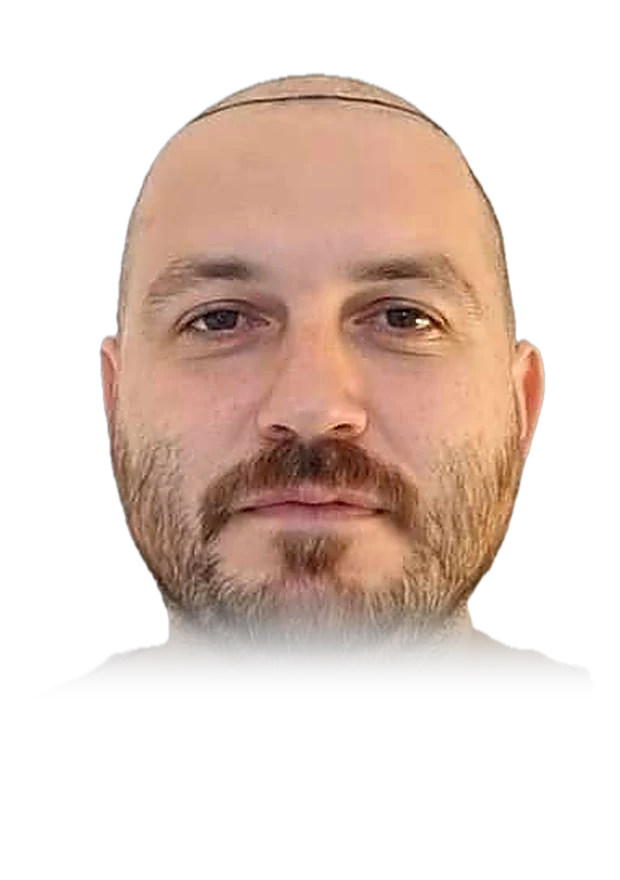 Tom W. — hair transplant, before