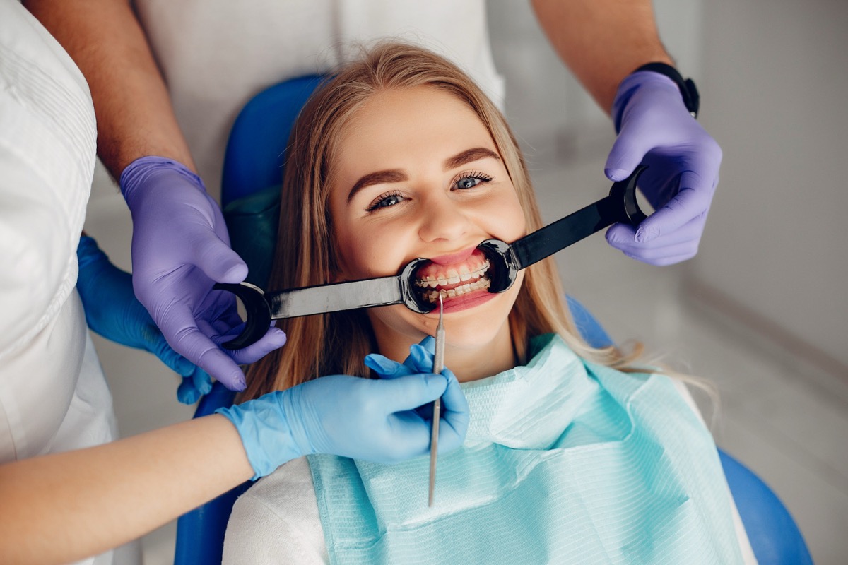 Veneers