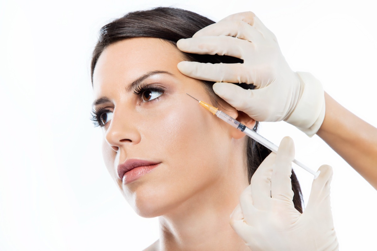 Epilazione laser