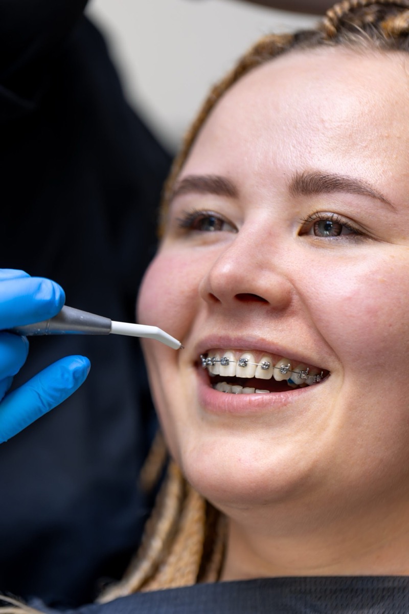 Ortodonzia e Invisalign