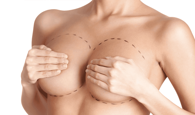 breast-aestetic-bg1