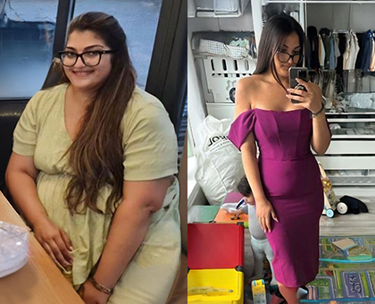 bariatric-before-after