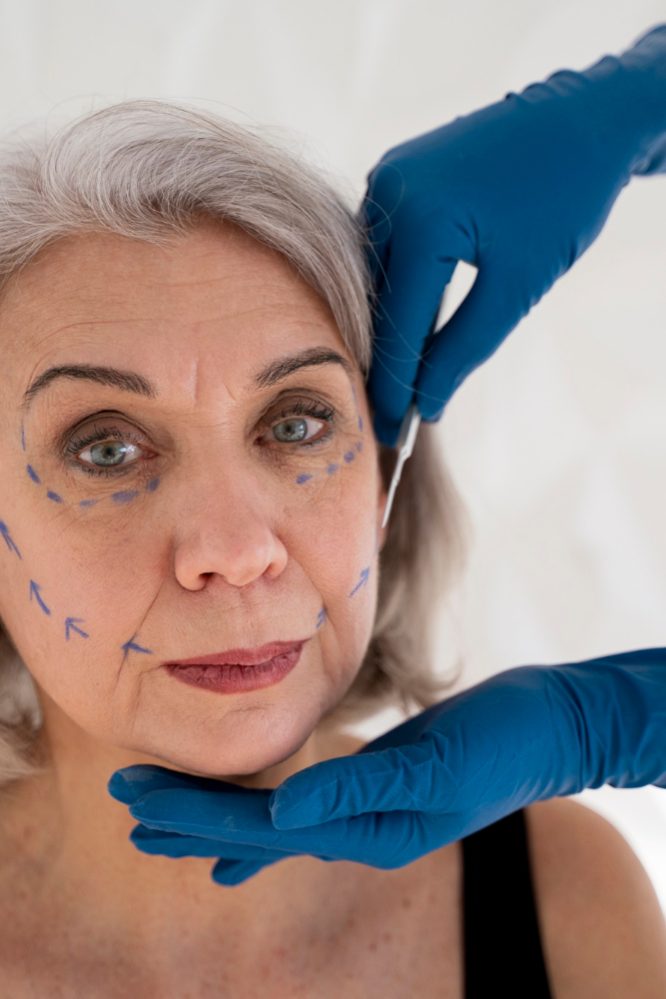 Facelift Surgery in Turkey