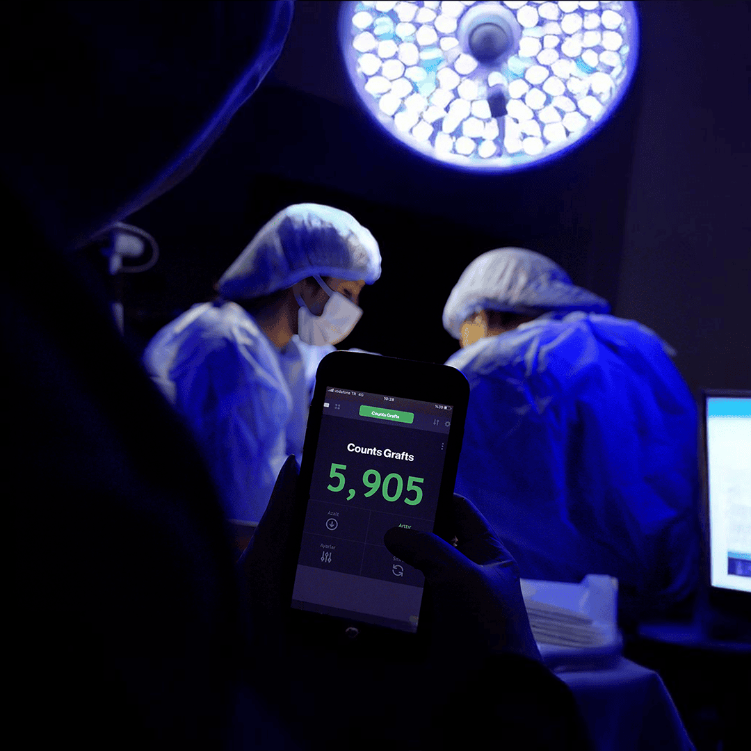 Stages of Sapphire FUE Hair Transplant